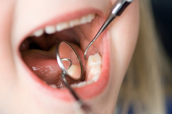 子供の歯科治療・定期検診（乳歯や永久歯）