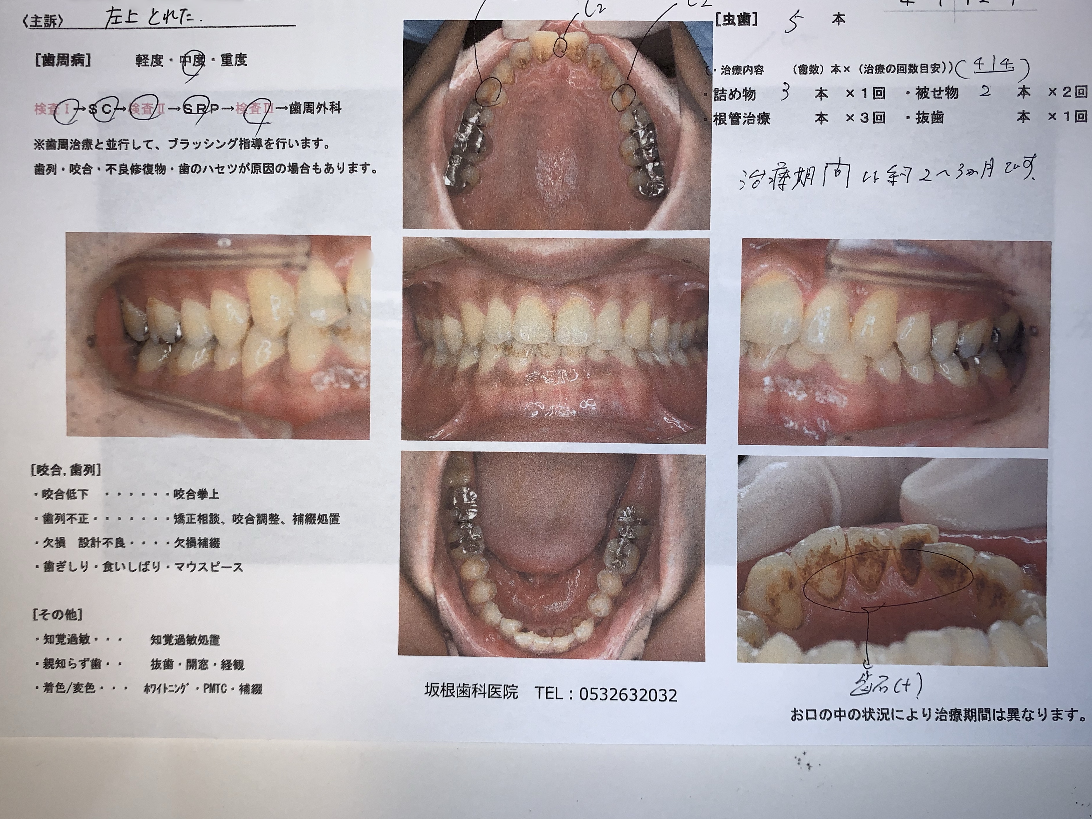 歯科治療の説明とカウンセリングについて